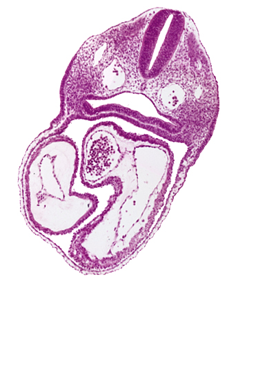 atrioventricular canal, cephalic edge of primary interatrial septum (septum primum), conus cordis, dermatomyotome 3 (O-3) , dorsal aorta, interatrial sulcus, left atrium, left ventricle, notochord, pharyngeal pouch 4, pharynx, precardinal vein, rhombencephalon (Rh. D), right atrium, sclerotome, somitocoel, sulcus limitans
