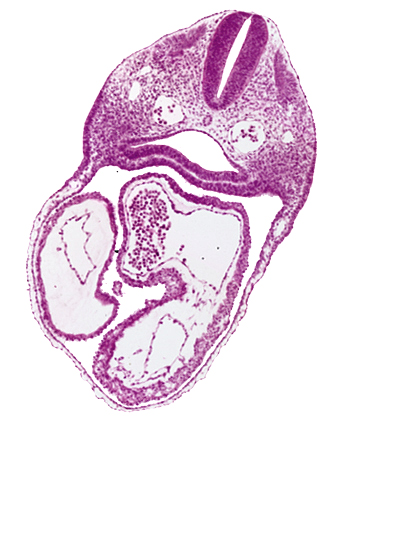 cardiac jelly, conus cordis, dermatomyotome 3 (O-3) , dorsal aorta, ectoderm, interatrial foramen (primum), interatrial sulcus, junction of conus cordis and right ventricle, left atrium, left ventricle, mesoderm, notochord, pericardial cavity, pharynx, rhombencephalon (Rh. D), right atrium, septum primum