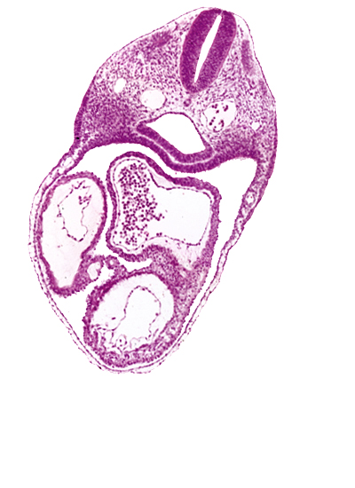 cephalic part of dermatomyotome 4 (O-4), dorsal aorta, interatrial foramen (primum), left atrium, left ventricle, origin of dorsal intersegmental artery, pericardial cavity, perinotochordal lamina, pharynx, precardinal vein, rhombencephalon (Rh. D), right atrium, right ventricle, ultimopharyngeal pouch