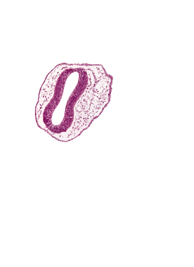 blood vessel(s), head mesenchyme, mesencephalon (M2), mesencoel, rhombencephalon (Rh. 1), rhombencoel (fourth ventricle), surface ectoderm