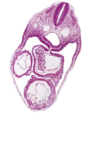 caudal end of pharynx, cephalic end of laryngotracheal groove, common atrium, dermatomyotome 4 (O-4) , left ventricle, mesocardium, pericardial cavity, rhombencephalon (Rh. D), rhombencoel (fourth ventricle), right ventricle, sclerotome, ultimopharyngeal pouch