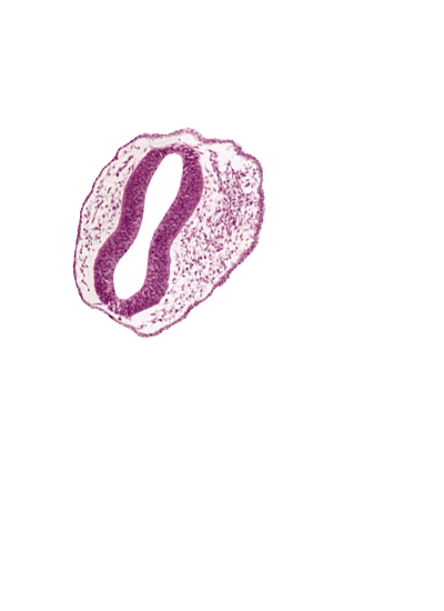 head mesenchyme, mesencephalon (M2), mesencoel, rhombencephalon (Rh. 1), rhombencoel (fourth ventricle), surface ectoderm, trigeminal neural crest (CN V)