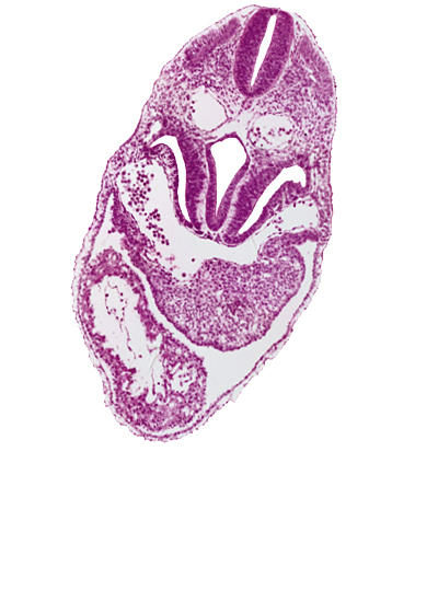 anterior interventricular sulcus, common ventricle, dermatomyotome 5 (C-1), dorsal aorta, floor plate, foregut, left ventricle, pericardial cavity, pericardioperitoneal canal (pleural cavity), postcardinal vein, respiratory primordium, right ventricle, roof plate, sclerotome, septum transversum, sinus venosus, sulcus limitans