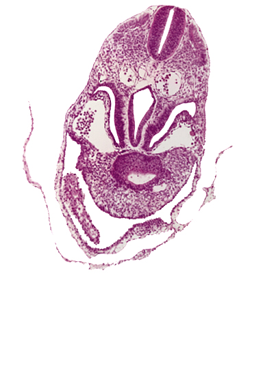 amnion, amnion attachment to ventral body wall (caudal part of head fold), amniotic cavity, caudal edge of ventricles, dermatomyotome 5 (C-1), foregut, hepatic antrum, left horn of sinus venosus, pericardial cavity, postcardinal vein, right horn of sinus venosus, septum transversum