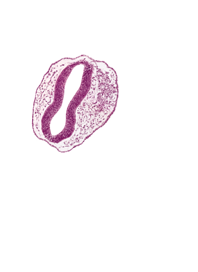 blood vessel(s), head mesenchyme, mesencephalon (M2), mesencoel, rhombencephalon (Rh. 1), rhombencoel (fourth ventricle), sulcus limitans, surface ectoderm, trigeminal neural crest (CN V)