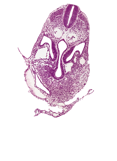amnion, amnion attachment to ventral body wall, amniotic cavity, caudal part of pericardial cavity, dermatomyotome 6 (C-2), hemopoietic tissue, hepatic venous plexus, left umbilical vein, left vitelline (omphalomesenteric) vein, midgut, postcardinal vein, right horn of sinus venosus, sclerotome, umbilical vesicle wall