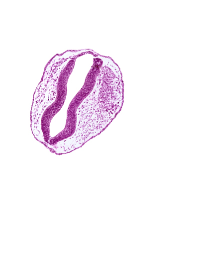 artifact separation(s), blood vessel(s), mesencephalon (M2), mesencoel, rhombencephalon (Rh. 1), rhombencephalon (Rh. 2), rhombencoel (fourth ventricle), roof plate, surface ectoderm, trigeminal neural crest (CN V)