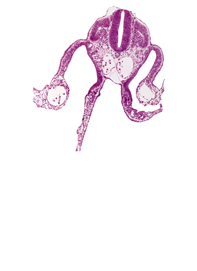 artifact space(s), communication between peritoneal cavity and extra-embryonic coelom, dermatomyotome 9 (C-5), dorsal aorta, midgut, notochord, presumptive upper limb bud, primordial omental bursa, right umbilical vein, umbilical vesicle wall