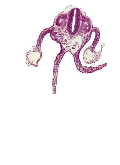 dermatomyotome 10 (C-6), left umbilical vein, notochord, peritoneal cavity, primordial omental bursa, right umbilical vein, sulcus limitans