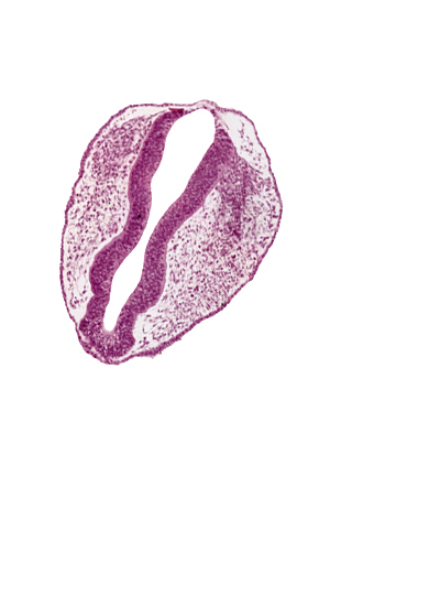 blood vessel(s), ectoderm, head mesenchyme, mesencephalon (M1), mesencephalon (M2), mesencoel, rhombencephalon (Rh. 1), rhombencephalon (Rh. 2), rhombencoel (fourth ventricle), roof plate, trigeminal neural crest (CN V)