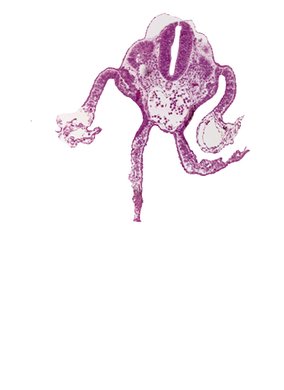 amnion attachment, amniotic cavity, dermatomyotome 11 (C-7), dorsal aorta, mesonephric vesicle(s), midgut, neural tube, peritoneal cavity, primordial omental bursa, umbilical vesicle cavity