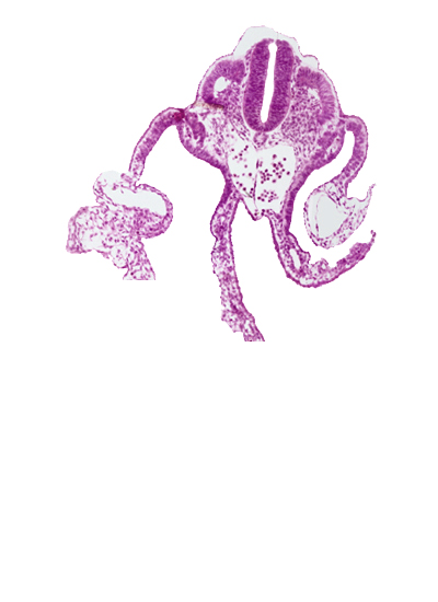 dermatomyotome 11 (C-7), dorsal aorta, left umbilical vein, midgut, origin of vitelline (omphalomesenteric) artery, presumptive upper limb bud, sclerotome, surface ectoderm, umbilical vesicle wall