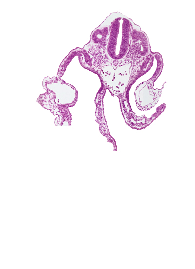 dermatomyotome 11 (C-7), left umbilical vein, right umbilical vein, surface ectoderm