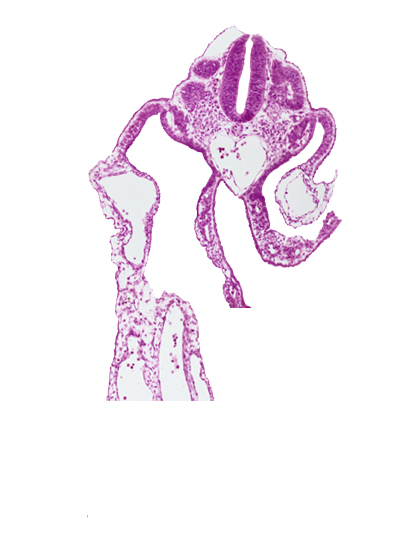 aorta, common umbilical artery, dermatomyotome 11 (C-7), left umbilical vein, right umbilical vein