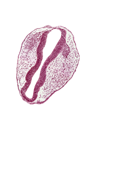 head mesenchyme, mesencephalon (M1), mesencephalon (M2), mesencoel, rhombencephalon (Rh. 1), rhombencephalon (Rh. 2), rhombencoel (fourth ventricle), trigeminal neural crest (CN V)