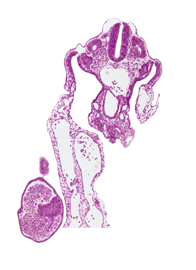amniotic cavity, aorta, caudal wall of cloaca, common umbilical artery, dermatomyotome 12 (C-8), hindgut, hindgut arterial plexus, separation artifact