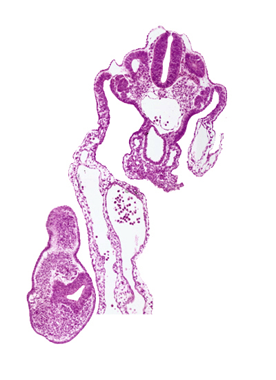 amnion attachment, aorta, caudal edge of cloacal lumen, caudal eminence, cloacal membrane, communication between peritoneal cavity and extra-embryonic coelomic cavity, dermatomyotome 12 (C-8), mesonephric duct, mesonephric vesicle(s)