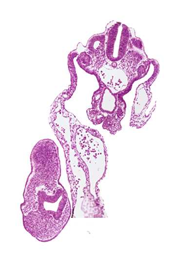 aorta, caudal edge of dermatomyotome 12 (C-8), caudal eminence, cloacal membrane, common umbilical artery, gastrulation (primitive) streak, mesonephric vesicle(s), presumptive upper limb bud, separation artifact