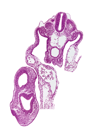 common umbilical artery, dermatomyotome 13 (T-1), gastrulation (primitive) streak, left umbilical vein, mesonephric vesicle(s), neural plate, origin of vitelline (omphalomesenteric) artery, peritoneal cavity, presumptive upper limb bud, primordial genital ridge, right umbilical vein, surface ectoderm