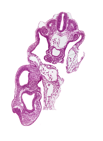 allantois, caudal edge of notochord, common umbilical artery, dermatomyotome 13 (T-1), dorsal aorta, gastrulation (primitive) streak, left umbilical vein, mesoderm, mesonephric vesicle(s), peritoneal cavity, primordial genital ridge, right umbilical vein, sclerotome, somitocoel