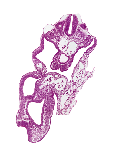 allantois, aorta, artifact separation(s), caudal edge of dermatomyotome 13 (T-1), caudal edge of presumptive upper limb bud, cloaca, hindgut, junction of umbilical arteries, mesonephric duct, peritoneal cavity