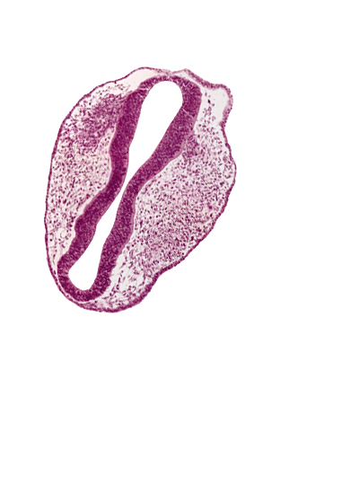 caudal edge of trigeminal neural crest (CN V), diencephalon (D2), mesencephalon (M1), mesencephalon (M2), mesencoel, prosencoel (third ventricle), rhombencephalon (Rh. 1), rhombencephalon (Rh. 2), rhombencoel (fourth ventricle), roof plate