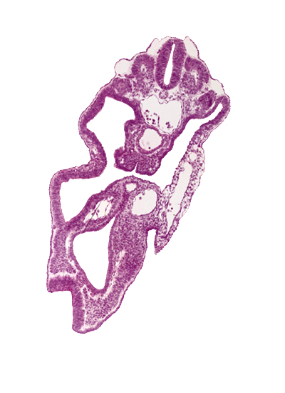 allantois, aorta, cloaca, dermatomyotome 14 (T-2), hindgut, left umbilical artery, left umbilical vein, mesonephric vesicle(s), neural fold, neural plate, notochord, peritoneal cavity, right umbilical artery, sclerotome, somitocoel