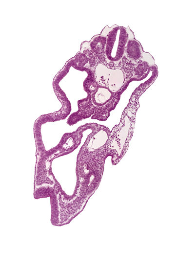 aorta, cloaca, dermatomyotome 14 (T-2), hindgut, junction of allantois and cloaca, left umbilical artery, mesonephric duct, right umbilical artery