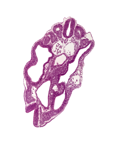 cloaca, dermatomyotome 15 (T-3), hindgut, left umbilical artery, left umbilical vein, mesonephric duct, notochord, paraxial mesoderm, peritoneal cavity, sclerotome