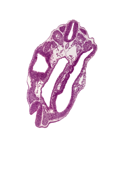 dermatomyotome 15 (T-3), left common iliac artery, notochord, peritoneal cavity, right common iliac artery, somatopleuric mesoderm