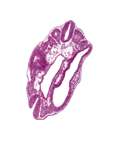 caudal edge of peritoneal cavity, cephalic edge of caudal neuropore, dermatomyotome 16 (T-4), hindgut, peritoneal cavity, sclerotome