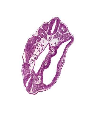 dermatomyotome 16 (T-4), fusing neural folds, hindgut, junction of aorta and right common iliac artery, left common iliac artery, neural tube, notochord, perinotochordal lamina, peritoneal cavity, somatopleure, splanchnopleure, ventral edge of somite 17 (T-5)