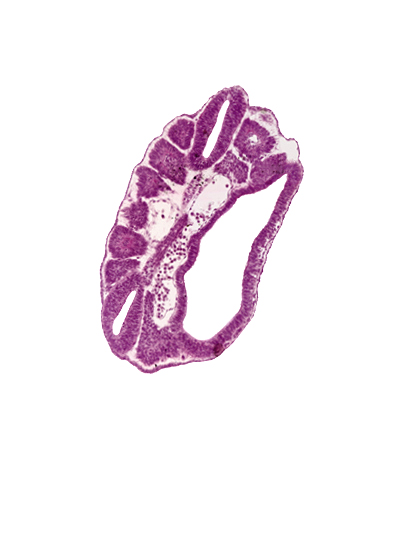 caudal edge of dermatomyotome 16 (T-4), dermatomyotome 16 - somite 17 intersegmental region, left common iliac artery, notochord, paraxial mesoderm, peritoneal cavity, right common iliac artery, somite 17 (T-5), somite 17-18 intersegmental space, somitocoel, ventral edge of somite 18 (T-6)