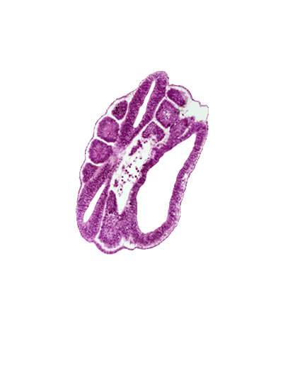 caudal edge of somite 17 (T-5), floor plate, intermediate mesenchyme, junction of aorta and left common iliac artery, neural tube, paraxial mesoderm, roof plate, somite 18 (T-6), somitocoel, sulcus limitans, ventral edge of somite 19 (T-7), ventral edge of somite 20 (T-8), ventral edge of somite 21 (T-9), ventral edge of somite 22 (T-10), ventral edge of somite 23 (T-11)