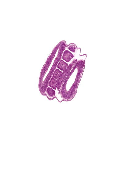 caudal edge of peritoneal cavity, dorsal edge of somite 18 (T-6), dorsal edge of somite 23 (T-11), intersegmental region, lumen of neural tube, mesonephric duct, neural tube wall, somite 19 (T-7), somite 20 (T-8), somite 21 (T-9), somite 22 (T-10), surface ectoderm