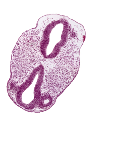 diencephalon (D1), diencephalon (D2), facio-vestibulocochlear neural crest (CN VII and CN VIII), intraretinal space (optic vesicle cavity), optic vesicle (D1), region of mesencephalic (cephalic) flexure, rhombencephalon (Rh. 2), rhombencephalon (Rh. 3), rhombencephalon (Rh. 4), surface ectoderm, venous plexus(es)