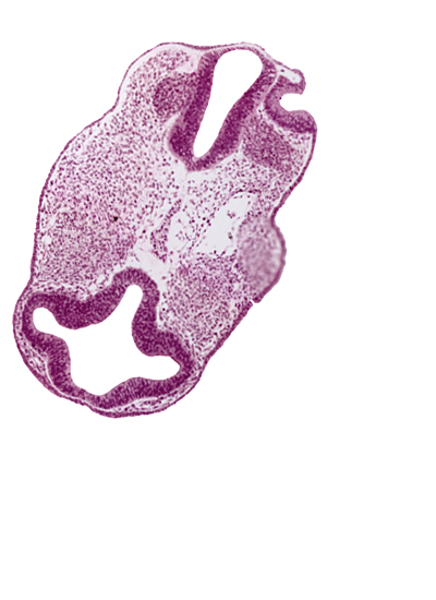 diencephalon (D1), diencephalon (D2), dorsal aorta, facio-vestibulocochlear neural crest (CN VII and CN VIII), intraretinal space (optic vesicle cavity), open otic vesicle, optic vesicle (D1), origin of internal carotid artery, otic pit, perinotochordal lamina, prosencoel (third ventricle), rhombencephalon (Rh. 4), surface ectoderm, venous plexus(es)