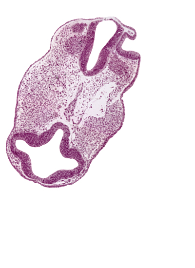 diencephalon (D1), diencephalon (D2), dorsal aorta, facio-vestibulocochlear neural crest (CN VII and CN VIII), optic vesicle (D1), otic pit, prosencoel (third ventricle), rhombencephalon (Rh. 4), surface ectoderm