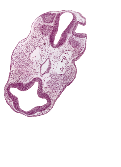 cephalic edge of pharynx lumen, cephalic tip of notochord, diencephalon (D2), dorsal aorta, epipharyngeal placode 2, facio-vestibulocochlear neural crest (CN VII and CN VIII), internal carotid artery, nasal disc (olfactory placode), neuropore site, notochord, optic vesicle (D1), otic pit, prosencoel (third ventricle), rhombencephalon (Rh. 4), rhombencephalon (Rh. 5), telencephalon medium (T)