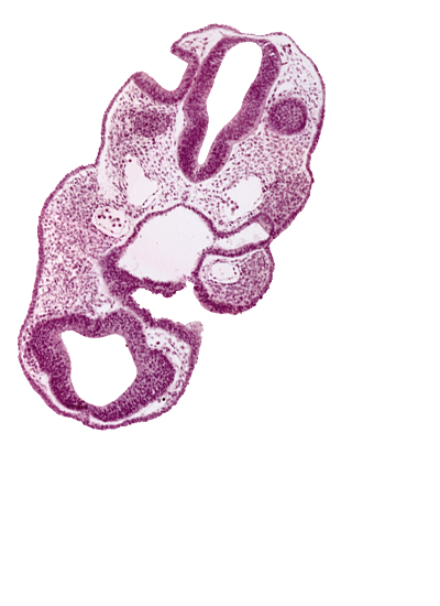 adenohypophysial pouch, aortic arch 1, chiasmatic plate (D1), dorsal aorta, neuropore site, pharyngeal pouch 1, prosencoel (third ventricle), rhombencephalon (Rh. 5), telencephalon medium (T)