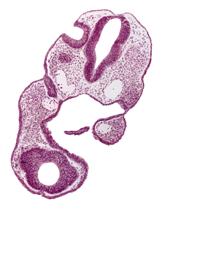 adenohypophysial pouch, aortic arch 1, caudal edge of otic vesicle, dorsal aorta, edge of optic vesicle, endoderm, neuropore site, notochord, oropharyngeal membrane, pharyngeal pouch 1, primary head vein tributary, prosencoel (third ventricle), rhombencephalon (Rh. 5), rhombencephalon (Rh. 6), telencephalon medium (T)