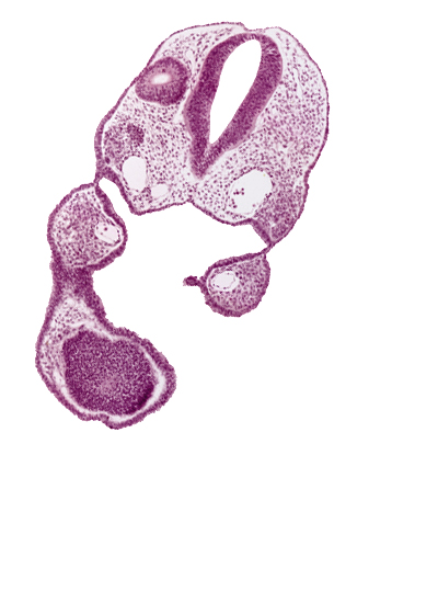 aortic arch 1, ectoderm, endoderm, left dorsal aorta, nasal disc (olfactory placode), notochord, otic vesicle, pharyngeal arch 1, pharyngeal pouch 1, pharynx, remnant of oropharyngeal membrane, rhombencephalon (Rh. 6), stomodeum, telencephalon medium (T), wall separating right dorsal aorta