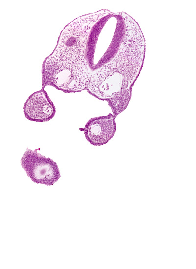 aortic arch 1, caudal edge of otic vesicle, cephalic edge of telencephalon medium (T), cephalic part of head, dorsal aorta, ectoderm, glossopharyngeal neural crest (CN IX), mesenchyme, pharyngeal membrane 1, pharynx, remnant of oropharyngeal membrane, rhombencephalon (Rh. 5), rhombencephalon (Rh. 6), stomodeum