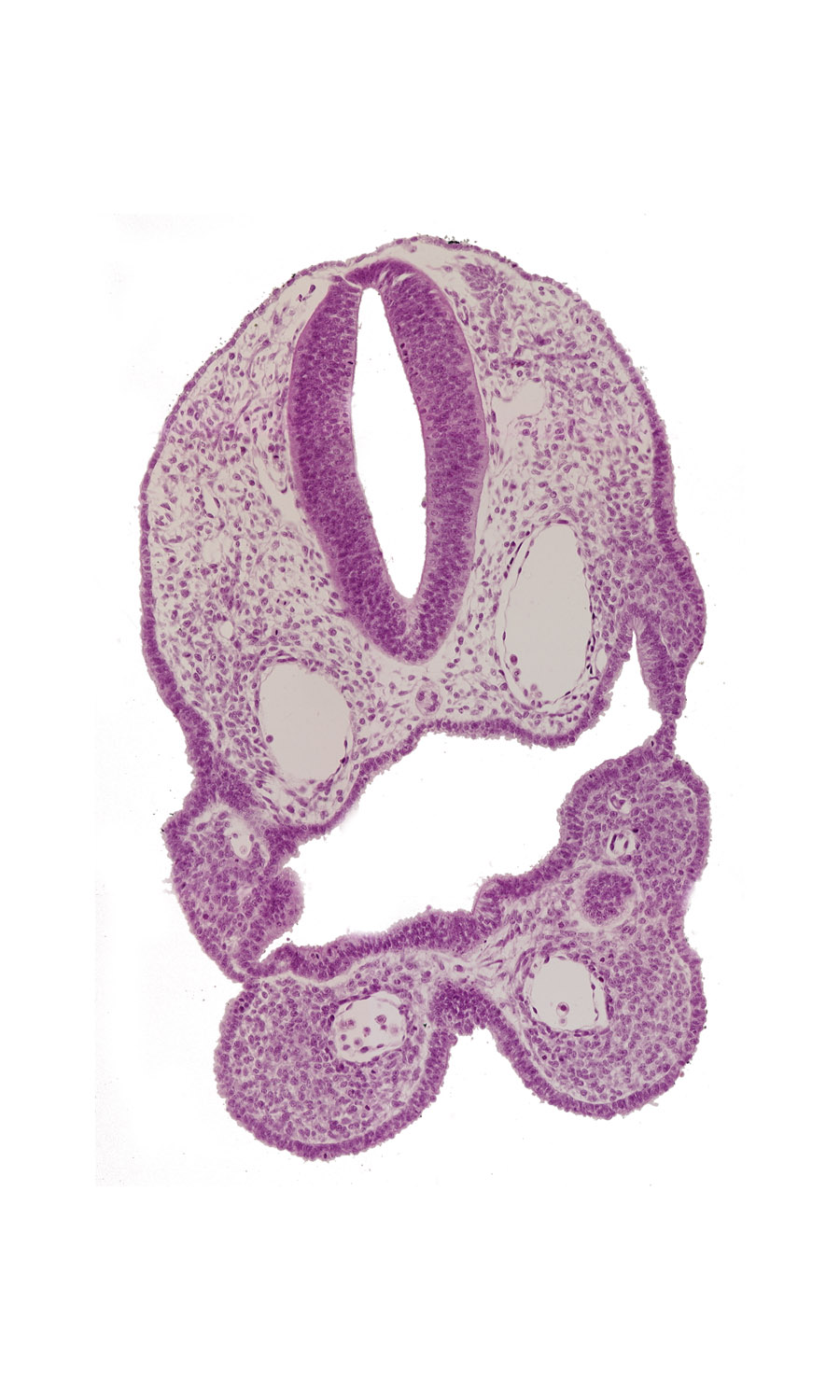 aortic arch 1, aortic arch 2, caudal edge of pharyngeal pouch 1, cephalic edge of dermatomyotome 1 (O-1), cephalic edge of thyroid diverticulum, head mesenchyme, junction of precardinal and primary head veins, median mandibular groove, notochord, pharyngeal arch 1 mesenchyme, pharyngeal membrane 2, pharyngeal pouch 2, pharynx, rhombencephalon (Rh. D)