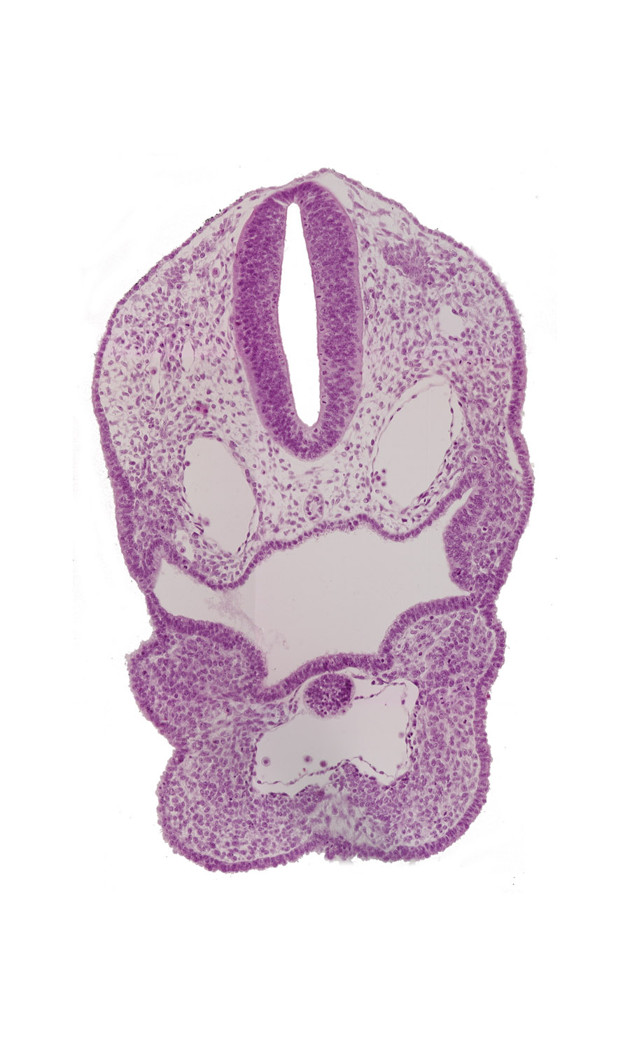 aortic sac, dermatomyotome 1 (O-1), dorsal aorta, perinotochordal lamina, pharyngeal arch 3, pharyngeal groove 1, pharyngeal groove 2, pharyngeal groove 3, pharyngeal pouch 3, precardinal vein