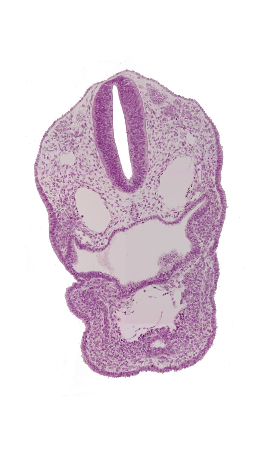 aortic sac, cephalic edge of pericardial sac, dermatomyotome 1 (O-1), dermatomyotome 2 (O-2) , dorsal aorta, ectodermal ring, perinotochordal lamina, pharyngeal arch 3, pharyngeal groove 1, pharyngeal groove 2, pharyngeal groove 3, pharyngeal pouch 3, precardinal vein