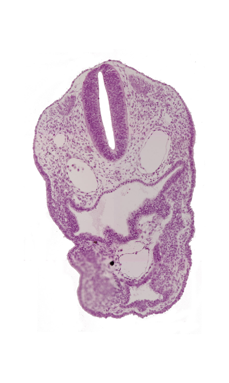 aortic sac, cephalic part of pericardial cavity, dermatomyotome 2 (O-2) , dorsal aorta, edge of aortic arch 3, pharyngeal groove 1, pharyngeal groove 2, pharyngeal groove 3, pharynx, precardinal vein