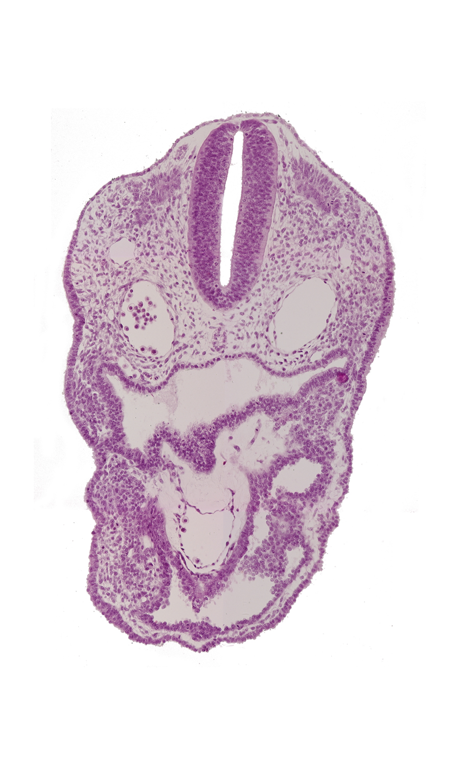 aortic sac, dermatomyotome 2 (O-2) , dorsal aorta, notochord, pericardial cavity, pharyngeal pouch 3, pharynx, rhombencephalon (Rh. D)