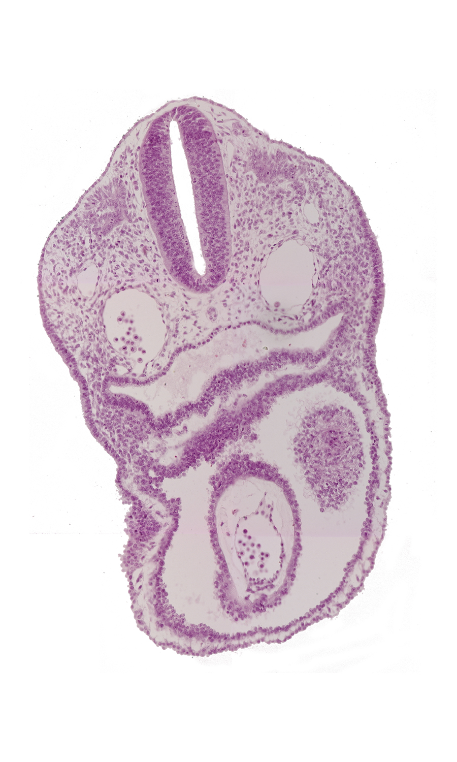 cephalic edge of left atrium, dermatomyotome 2 (O-2) , junction of aortic sac and truncus arteriosus, notochord, pericardial cavity, pericardial sac, pharyngeal pouch 4, pharynx, precardinal vein