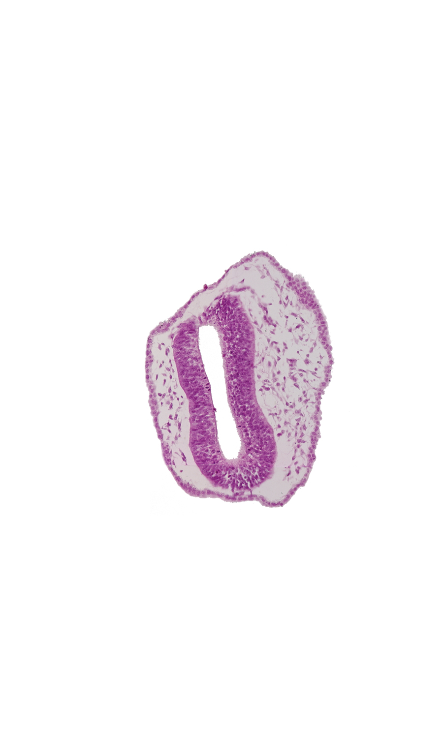 head mesenchyme, mesencephalon (M2), mesencoel, rhombencephalon (Rh. 1), rhombencoel (fourth ventricle), surface ectoderm